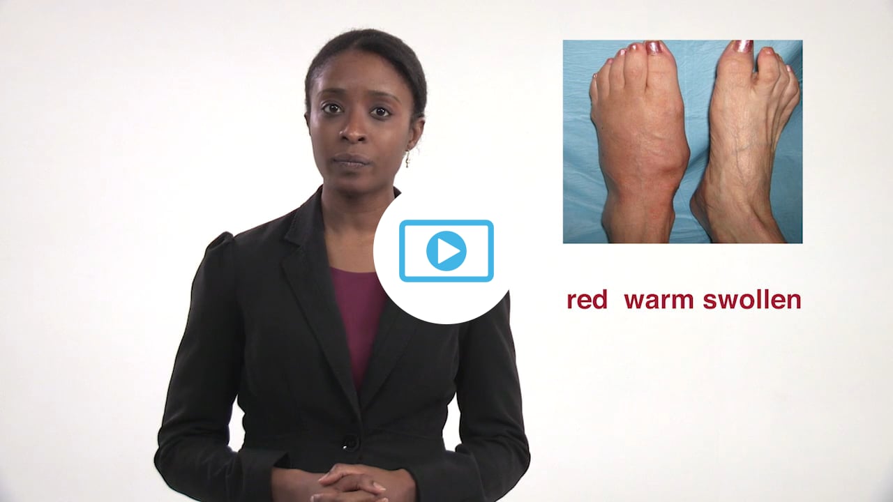 Image for Does my foot wound need urgent attention?