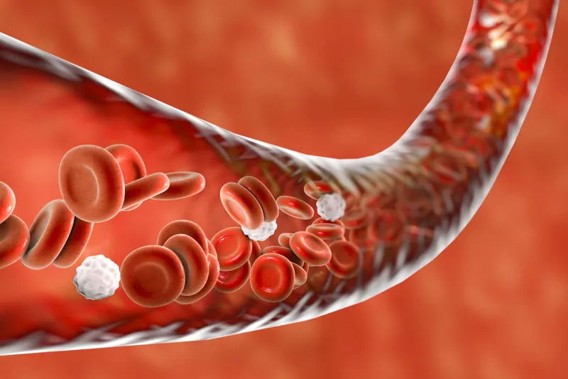 Continuous glucose monitoring (CGM) Test 18
