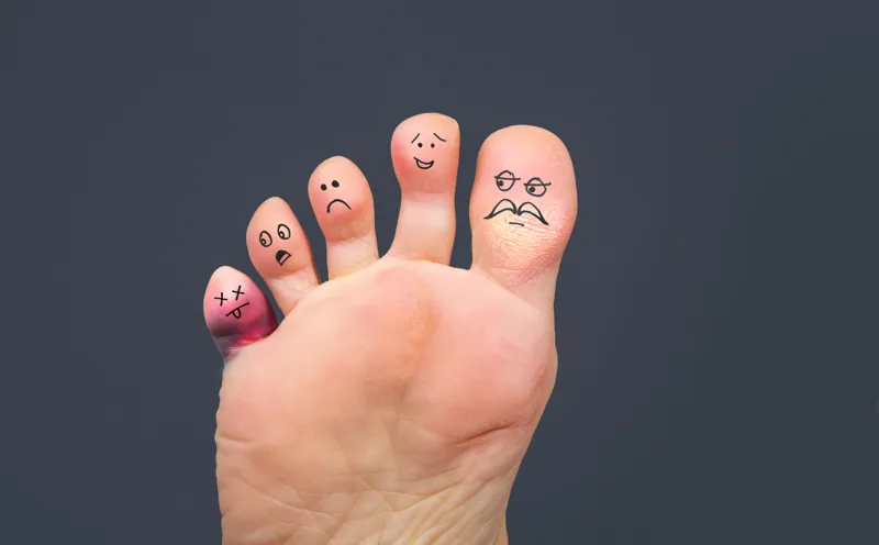 Urdu - Looking after your diabetic foot ulcer