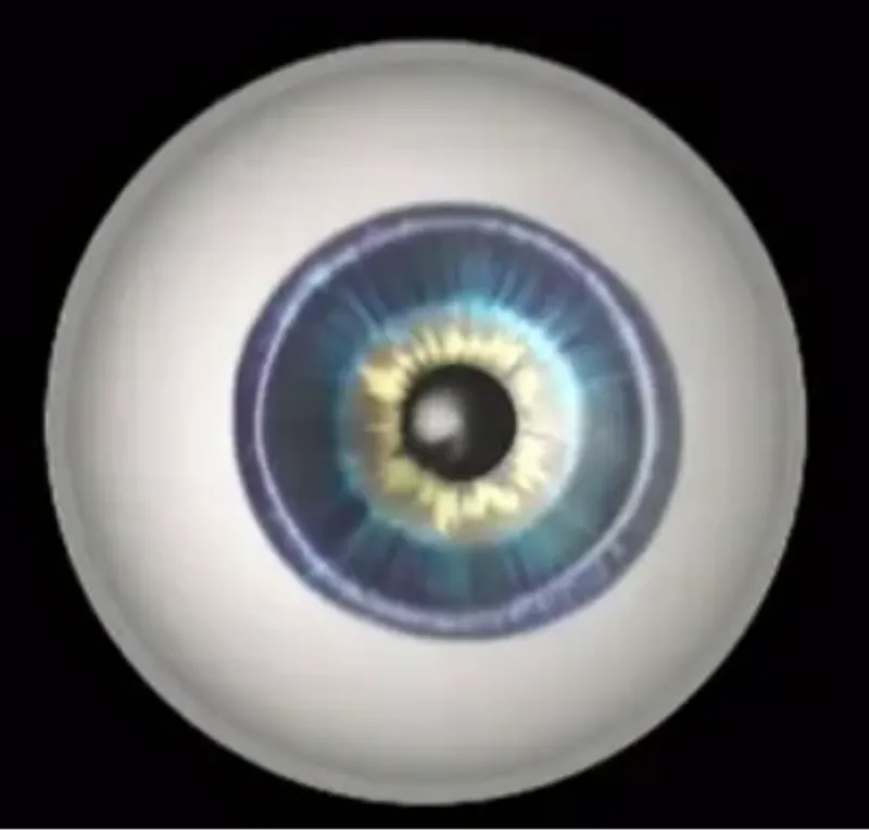 Bengali - Diabetic Retinopathy