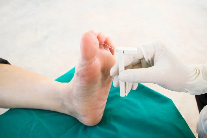 Somerset Foot Service - High Risk of Developing a Foot Ulcer