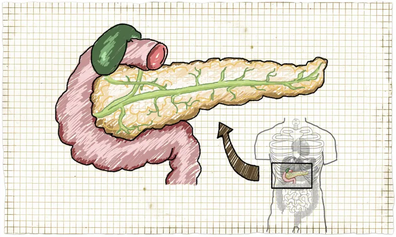 Maturity Onset Diabetes of the Young (MODY)