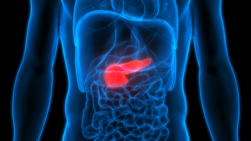 Latent Autoimmune Diabetes of the Adult (LADA)