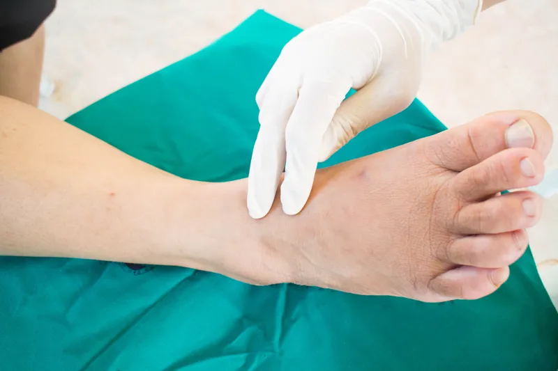 Somerset Foot Service - Low Risk of Developing a Foot Ulcer
