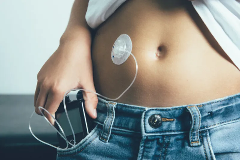 Considering an Insulin Pump?